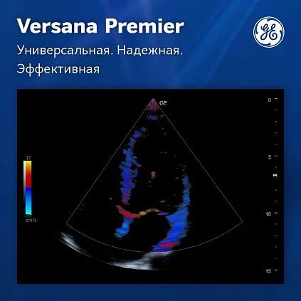 Клинические изображения Ультразвуковая система GE Versana Premier Platinum