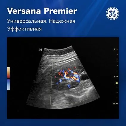 Клинические изображения Ультразвуковая система GE Versana Premier Platinum