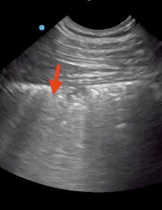 3.gif